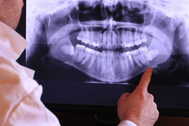 Best Weekend Emergency Dentist in Corydon, IN