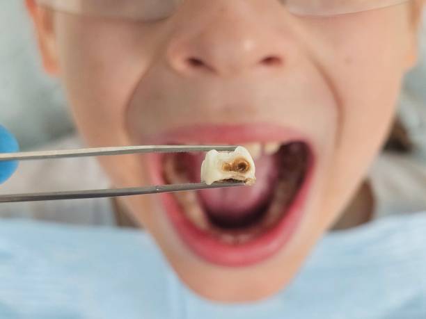 Best Emergency Treatment for Toothache in Corydon, IN